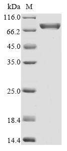 (Tris-Glycine gel) Discontinuous SDS-PAGE (reduced) with 5% enrichment gel and 15% separation gel. (Tris-Glycine gel) Discontinuous SDS-PAGE (reduced) with 5% enrichment gel and 15% separation gel.
