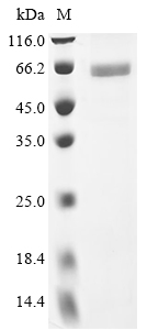 Recombinant Human N-myc proto-oncogene protein (MYCN) - image 1