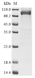 Recombinant Human Myosin-6 (MYH6) , partial - image 1