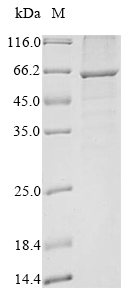 (Tris-Glycine gel) Discontinuous SDS-PAGE (reduced) with 5% enrichment gel and 15% separation gel. (Tris-Glycine gel) Discontinuous SDS-PAGE (reduced) with 5% enrichment gel and 15% separation gel.