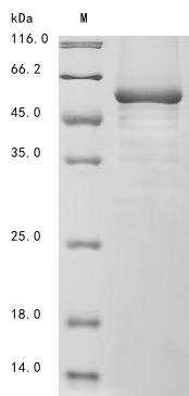 (Tris-Glycine gel) Discontinuous SDS-PAGE (reduced) with 5% enrichment gel and 15% separation gel. (Tris-Glycine gel) Discontinuous SDS-PAGE (reduced) with 5% enrichment gel and 15% separation gel.