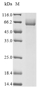 (Tris-Glycine gel) Discontinuous SDS-PAGE (reduced) with 5% enrichment gel and 15% separation gel. (Tris-Glycine gel) Discontinuous SDS-PAGE (reduced) with 5% enrichment gel and 15% separation gel.