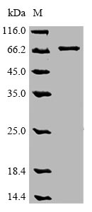 (Tris-Glycine gel) Discontinuous SDS-PAGE (reduced) with 5% enrichment gel and 15% separation gel. (Tris-Glycine gel) Discontinuous SDS-PAGE (reduced) with 5% enrichment gel and 15% separation gel.