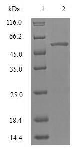 (Tris-Glycine gel) Discontinuous SDS-PAGE (reduced) with 5% enrichment gel and 15% separation gel. (Tris-Glycine gel) Discontinuous SDS-PAGE (reduced) with 5% enrichment gel and 15% separation gel.