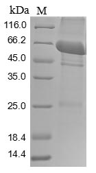 (Tris-Glycine gel) Discontinuous SDS-PAGE (reduced) with 5% enrichment gel and 15% separation gel. (Tris-Glycine gel) Discontinuous SDS-PAGE (reduced) with 5% enrichment gel and 15% separation gel.
