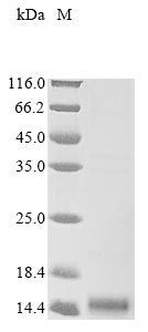(Tris-Glycine gel) Discontinuous SDS-PAGE (reduced) with 5% enrichment gel and 15% separation gel. (Tris-Glycine gel) Discontinuous SDS-PAGE (reduced) with 5% enrichment gel and 15% separation gel.