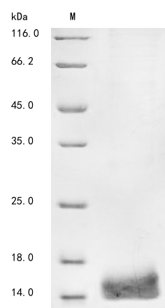 (Tris-Glycine gel) Discontinuous SDS-PAGE (reduced) with 5% enrichment gel and 15% separation gel. (Tris-Glycine gel) Discontinuous SDS-PAGE (reduced) with 5% enrichment gel and 15% separation gel.