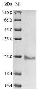 Recombinant Human Protein PML (PML) , partial - image 1
