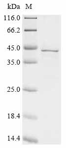 Recombinant Human Paraneoplastic antigen Ma2 (PNMA2) , partial - image 1