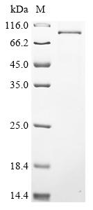 Recombinant Human DNA polymerase theta (POLQ) , partial - image 1
