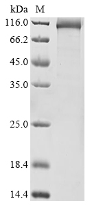 Recombinant Human DNA polymerase theta (POLQ) , partial - image 1