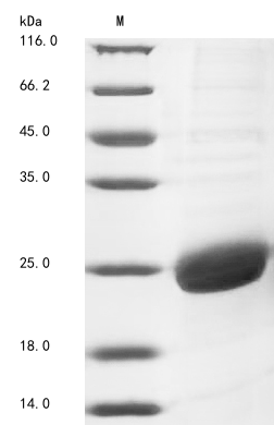 (Tris-Glycine gel) Discontinuous SDS-PAGE (reduced) with 5% enrichment gel and 15% separation gel. (Tris-Glycine gel) Discontinuous SDS-PAGE (reduced) with 5% enrichment gel and 15% separation gel.