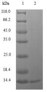 (Tris-Glycine gel) Discontinuous SDS-PAGE (reduced) with 5% enrichment gel and 15% separation gel. (Tris-Glycine gel) Discontinuous SDS-PAGE (reduced) with 5% enrichment gel and 15% separation gel.