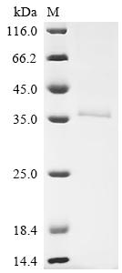 Recombinant Human Retinaldehyde-binding protein 1 (RLBP1) - image 1