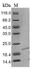 (Tris-Glycine gel) Discontinuous SDS-PAGE (reduced) with 5% enrichment gel and 15% separation gel. (Tris-Glycine gel) Discontinuous SDS-PAGE (reduced) with 5% enrichment gel and 15% separation gel.