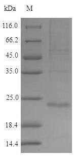 (Tris-Glycine gel) Discontinuous SDS-PAGE (reduced) with 5% enrichment gel and 15% separation gel. (Tris-Glycine gel) Discontinuous SDS-PAGE (reduced) with 5% enrichment gel and 15% separation gel.