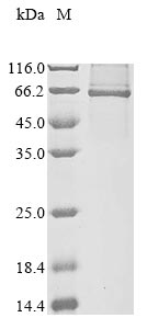 (Tris-Glycine gel) Discontinuous SDS-PAGE (reduced) with 5% enrichment gel and 15% separation gel. (Tris-Glycine gel) Discontinuous SDS-PAGE (reduced) with 5% enrichment gel and 15% separation gel.