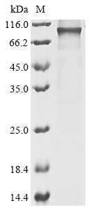(Tris-Glycine gel) Discontinuous SDS-PAGE (reduced) with 5% enrichment gel and 15% separation gel. (Tris-Glycine gel) Discontinuous SDS-PAGE (reduced) with 5% enrichment gel and 15% separation gel.