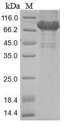(Tris-Glycine gel) Discontinuous SDS-PAGE (reduced) with 5% enrichment gel and 15% separation gel. (Tris-Glycine gel) Discontinuous SDS-PAGE (reduced) with 5% enrichment gel and 15% separation gel.