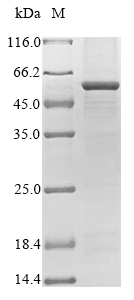 (Tris-Glycine gel) Discontinuous SDS-PAGE (reduced) with 5% enrichment gel and 15% separation gel. (Tris-Glycine gel) Discontinuous SDS-PAGE (reduced) with 5% enrichment gel and 15% separation gel.