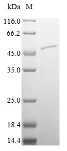 (Tris-Glycine gel) Discontinuous SDS-PAGE (reduced) with 5% enrichment gel and 15% separation gel. (Tris-Glycine gel) Discontinuous SDS-PAGE (reduced) with 5% enrichment gel and 15% separation gel.