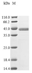 (Tris-Glycine gel) Discontinuous SDS-PAGE (reduced) with 5% enrichment gel and 15% separation gel. (Tris-Glycine gel) Discontinuous SDS-PAGE (reduced) with 5% enrichment gel and 15% separation gel.