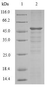 (Tris-Glycine gel) Discontinuous SDS-PAGE (reduced) with 5% enrichment gel and 15% separation gel. (Tris-Glycine gel) Discontinuous SDS-PAGE (reduced) with 5% enrichment gel and 15% separation gel.
