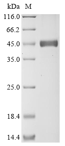 (Tris-Glycine gel) Discontinuous SDS-PAGE (reduced) with 5% enrichment gel and 15% separation gel. (Tris-Glycine gel) Discontinuous SDS-PAGE (reduced) with 5% enrichment gel and 15% separation gel.