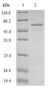 SDS-PAGE- Recombinant protein Human SFTPB