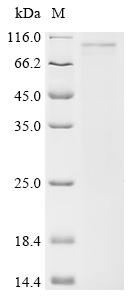 Recombinant Human Suppressor of cytokine signaling 6 (SOCS6) - image 1