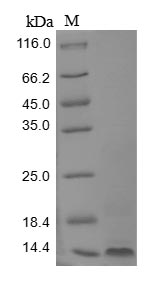 (Tris-Glycine gel) Discontinuous SDS-PAGE (reduced) with 5% enrichment gel and 15% separation gel. (Tris-Glycine gel) Discontinuous SDS-PAGE (reduced) with 5% enrichment gel and 15% separation gel.