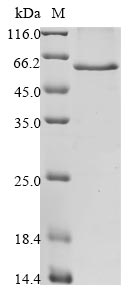 (Tris-Glycine gel) Discontinuous SDS-PAGE (reduced) with 5% enrichment gel and 15% separation gel. (Tris-Glycine gel) Discontinuous SDS-PAGE (reduced) with 5% enrichment gel and 15% separation gel.