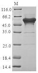 SDS-PAGE- Recombinant protein Human SSB