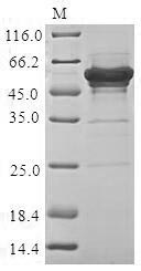 (Tris-Glycine gel) Discontinuous SDS-PAGE (reduced) with 5% enrichment gel and 15% separation gel. (Tris-Glycine gel) Discontinuous SDS-PAGE (reduced) with 5% enrichment gel and 15% separation gel.