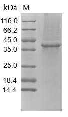 (Tris-Glycine gel) Discontinuous SDS-PAGE (reduced) with 5% enrichment gel and 15% separation gel. (Tris-Glycine gel) Discontinuous SDS-PAGE (reduced) with 5% enrichment gel and 15% separation gel.