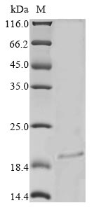 (Tris-Glycine gel) Discontinuous SDS-PAGE (reduced) with 5% enrichment gel and 15% separation gel. (Tris-Glycine gel) Discontinuous SDS-PAGE (reduced) with 5% enrichment gel and 15% separation gel.