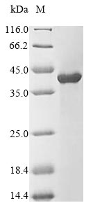 (Tris-Glycine gel) Discontinuous SDS-PAGE (reduced) with 5% enrichment gel and 15% separation gel. (Tris-Glycine gel) Discontinuous SDS-PAGE (reduced) with 5% enrichment gel and 15% separation gel.