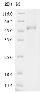 Recombinant Human E3 ubiquitin-protein ligase TRIM21 (TRIM21) - image 1