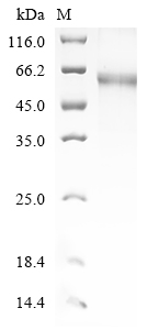 (Tris-Glycine gel) Discontinuous SDS-PAGE (reduced) with 5% enrichment gel and 15% separation gel. (Tris-Glycine gel) Discontinuous SDS-PAGE (reduced) with 5% enrichment gel and 15% separation gel.
