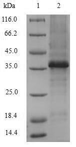 SDS-PAGE- Recombinant protein Human VCAN