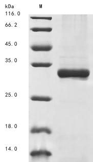 (Tris-Glycine gel) Discontinuous SDS-PAGE (reduced) with 5% enrichment gel and 15% separation gel. (Tris-Glycine gel) Discontinuous SDS-PAGE (reduced) with 5% enrichment gel and 15% separation gel.