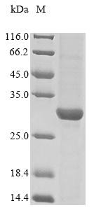 (Tris-Glycine gel) Discontinuous SDS-PAGE (reduced) with 5% enrichment gel and 15% separation gel. (Tris-Glycine gel) Discontinuous SDS-PAGE (reduced) with 5% enrichment gel and 15% separation gel.