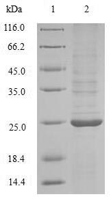 (Tris-Glycine gel) Discontinuous SDS-PAGE (reduced) with 5% enrichment gel and 15% separation gel.