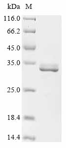 (Tris-Glycine gel) Discontinuous SDS-PAGE (reduced) with 5% enrichment gel and 15% separation gel. (Tris-Glycine gel) Discontinuous SDS-PAGE (reduced) with 5% enrichment gel and 15% separation gel.