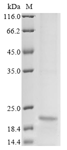 (Tris-Glycine gel) Discontinuous SDS-PAGE (reduced) with 5% enrichment gel and 15% separation gel. (Tris-Glycine gel) Discontinuous SDS-PAGE (reduced) with 5% enrichment gel and 15% separation gel.