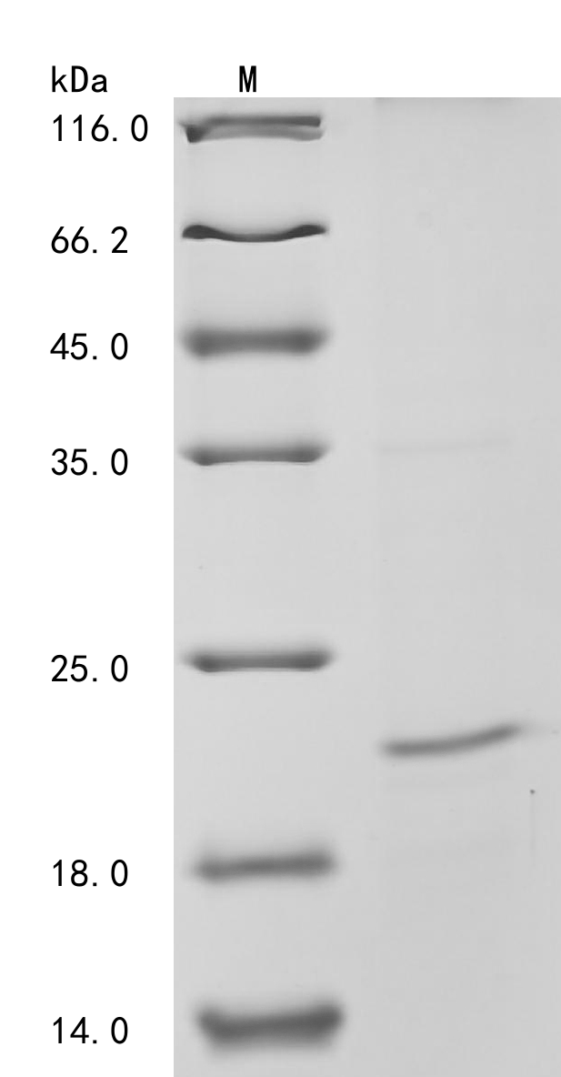 (Tris-Glycine gel) Discontinuous SDS-PAGE (reduced) with 5% enrichment gel and 15% separation gel. (Tris-Glycine gel) Discontinuous SDS-PAGE (reduced) with 5% enrichment gel and 15% separation gel.