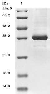 (Tris-Glycine gel) Discontinuous SDS-PAGE (reduced) with 5% enrichment gel and 15% separation gel. (Tris-Glycine gel) Discontinuous SDS-PAGE (reduced) with 5% enrichment gel and 15% separation gel.