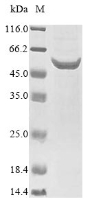 (Tris-Glycine gel) Discontinuous SDS-PAGE (reduced) with 5% enrichment gel and 15% separation gel. (Tris-Glycine gel) Discontinuous SDS-PAGE (reduced) with 5% enrichment gel and 15% separation gel.