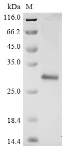 (Tris-Glycine gel) Discontinuous SDS-PAGE (reduced) with 5% enrichment gel and 15% separation gel. (Tris-Glycine gel) Discontinuous SDS-PAGE (reduced) with 5% enrichment gel and 15% separation gel.