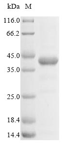 (Tris-Glycine gel) Discontinuous SDS-PAGE (reduced) with 5% enrichment gel and 15% separation gel. (Tris-Glycine gel) Discontinuous SDS-PAGE (reduced) with 5% enrichment gel and 15% separation gel.